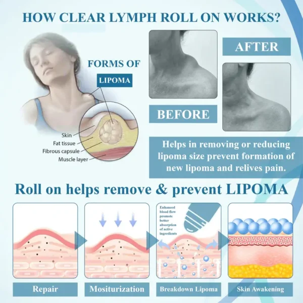 Fivfivgo™ LumpsClear Lymphstütze Roll-On
