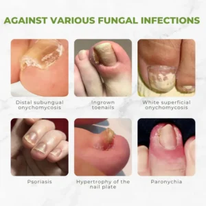 Flycare™ FungiVanish Bee Venom Nail Treatment Oil