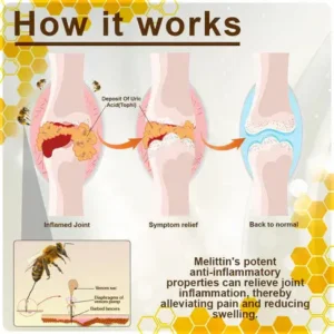Flycare™ TheraVen Bee Venom Joint Relief Gel