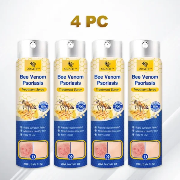 ODALIT™PsoriaHeal psoriasis Spray