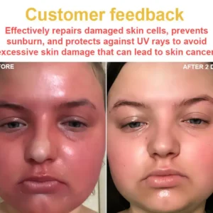 RTSSKE™ Bee Venom Skin Cream