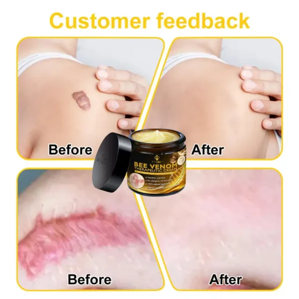 RTSSKE™ Bee Venom Skin Cream