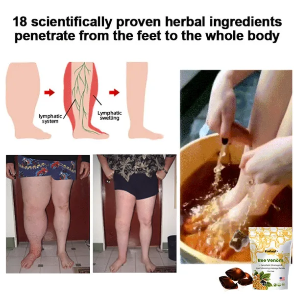 Voilaist™ Bee Venom Lymphatic Drainage & Slimming Foot SoakBeads