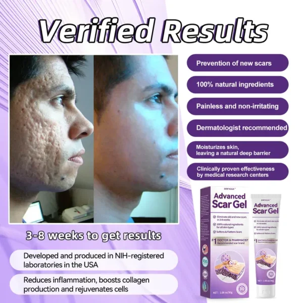 Zoencgz™ Advanced Scar Gel