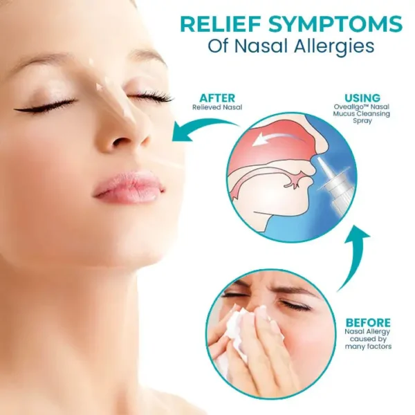Fivfivgo™ Nasal Mucus Cleansing Spray - Image 4