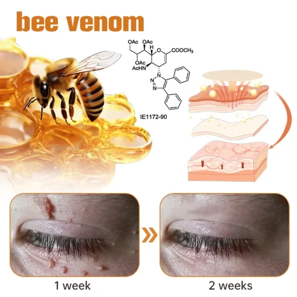 Fivfivgo™ WartGone Bee Venom Treatment Patch - Image 8
