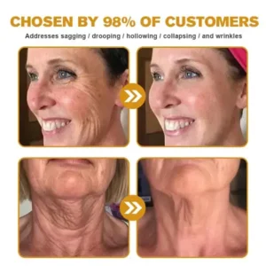Special Discount Furzero™ Botox Bee Venom Wrinkle Removal Cream