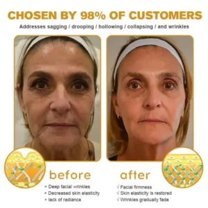 Special Discount Furzero™ Botox Bee Venom Wrinkle Removal Cream