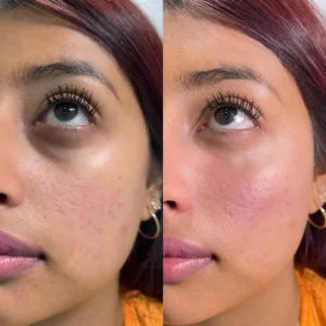 Celyn™ Firming Cream