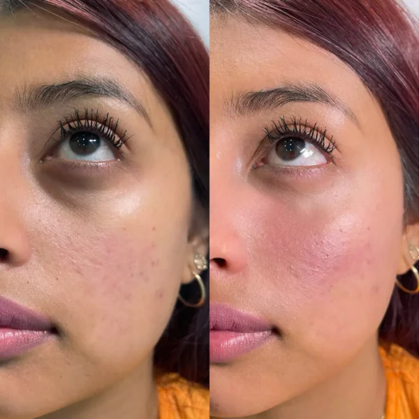 Celyn™ Firming Cream