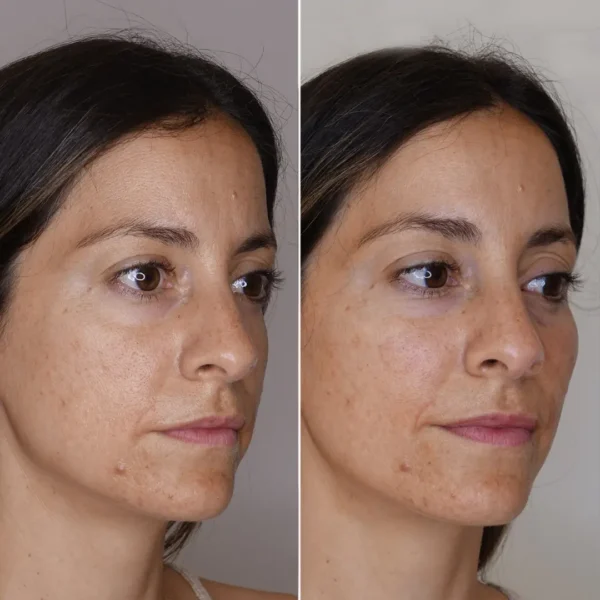 Celyn™ Firming Cream