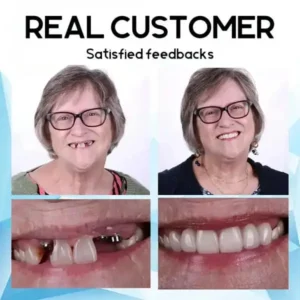 Mega Sale QIAWI™ Premium Custom Silicone Denture Set American Dental Association (ADA) certified
