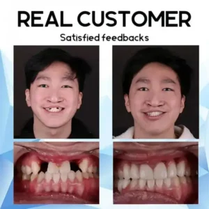 Mega Sale QIAWI™ Premium Custom Silicone Denture Set American Dental Association (ADA) certified