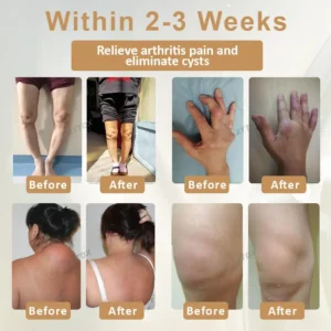 ATTDX® Emu Oil Turmeric Bone Sooth Gel