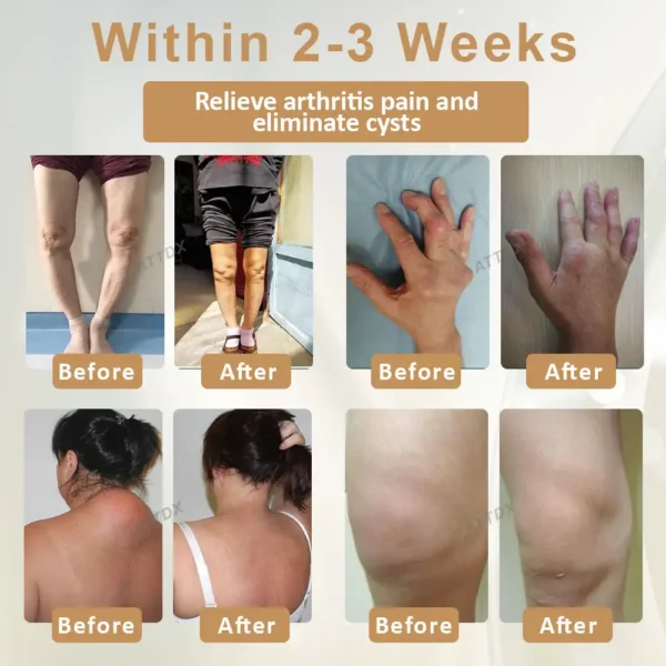ATTDX® Emu Oil Turmeric Bone Sooth Gel