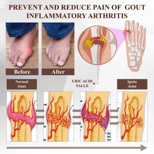 ATTDX® Emu Oil Turmeric Bone Sooth Gel
