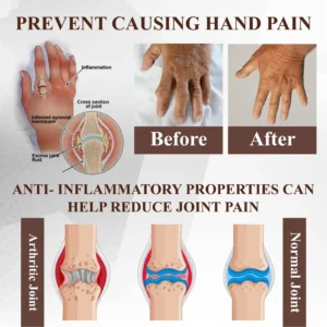 ATTDX® Emu Oil Turmeric Bone Sooth Gel