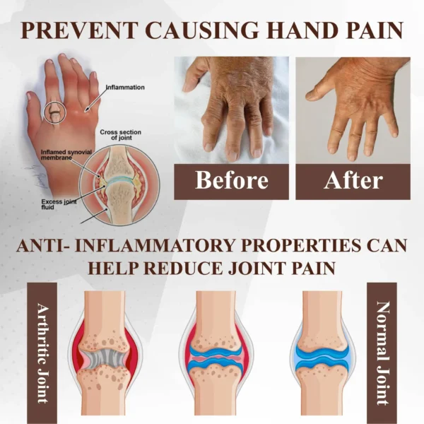 ATTDX® Emu Oil Turmeric Bone Sooth Gel
