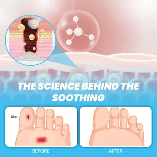 CVREOZ® GlucoFlow Diabetes Treatment Cream