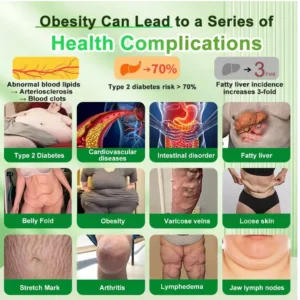 CVS Online๐ฅ | Croaieยฎ ๐๐๐ฃ-๐ญ ๐๐-๐ข๐ง-๐ ๐๐ฅ๐ข๐ฆ& ๐ฏ๐๐๐๐๐๐ฒ ๐ถ๐๐๐ ๐บ๐๐๐๐๐๐๐ ๐๐๐๐ ๐ ๐๐๐ฆ, ๐ฃ๐๐ ๐๐๐๐ ๐๐๐ ๐ข๐๐ก๐ ๐๐ 7 ๐๐๐ฆ๐ โ
๐ฆ๐๐ฝ๐ฝ๐ผ๐ฟ๐๐ ๐ผ๐ฏ๐ฒ๐๐ถ๐๐, ๐ฐ๐ฎ๐ฟ๐ฑ๐ถ๐ผ๐๐ฎ๐๐ฐ๐๐น๐ฎ๐ฟ ๐ต๐ฒ๐ฎ๐น๐๐ต, ๐ฑ๐ถ๐ฎ๐ฏ๐ฒ๐๐ฒ๐, ๐๐น๐ฒ๐ฒ๐ฝ ๐ฎ๐ฝ๐ป๐ฒ๐ฎ, ๐ด๐๐ ๐ต๐ฒ๐ฎ๐น๐๐ต, ๐ท๐ผ๐ถ๐ป๐ ๐ถ๐๐๐๐ฒ๐, ๐ฐ๐ก๐ข๐ฅ๐ ๐๐ฅ๐ฌ๐จ ๐๐ข๐ซ๐ฆ๐ข๐ง๐ ๐ญ๐ก๐ ๐ฌ๐ค๐ข๐ง ๐๐ง๐ ๐๐จ๐จ๐ฌ๐ญ๐ข๐ง๐ ๐๐ง๐๐ซ๐ ๐ฒ.