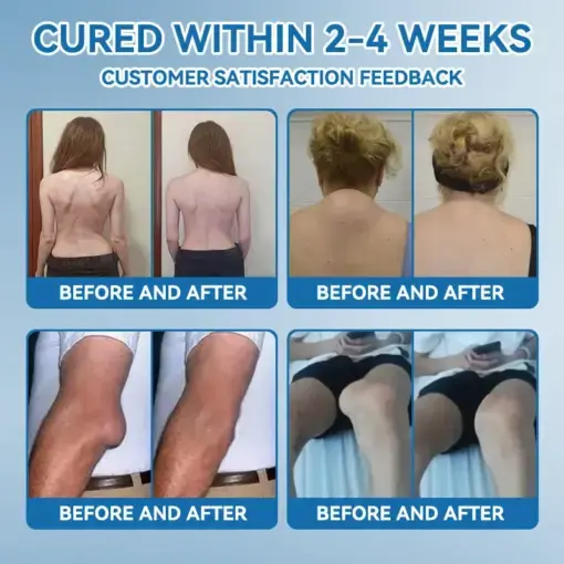 Croaie® ʙ.ᴘ.ᴄ-157 Joint Healing Cream