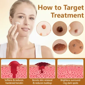 Timilk® BeeErase Multi-Action Renewal Cream (A)