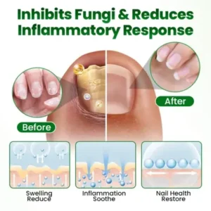 Timilk® HerbaNail 7-Day Repair Serum