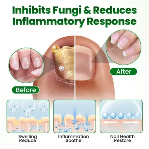 Timilk® HerbaNail 7-Day Repair Serum