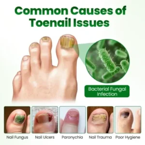 Timilk® HerbaNail 7-Day Repair Serum