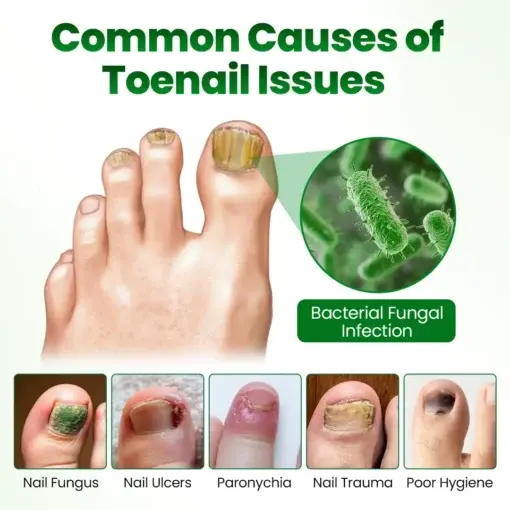 Timilk® HerbaNail 7-Day Repair Serum