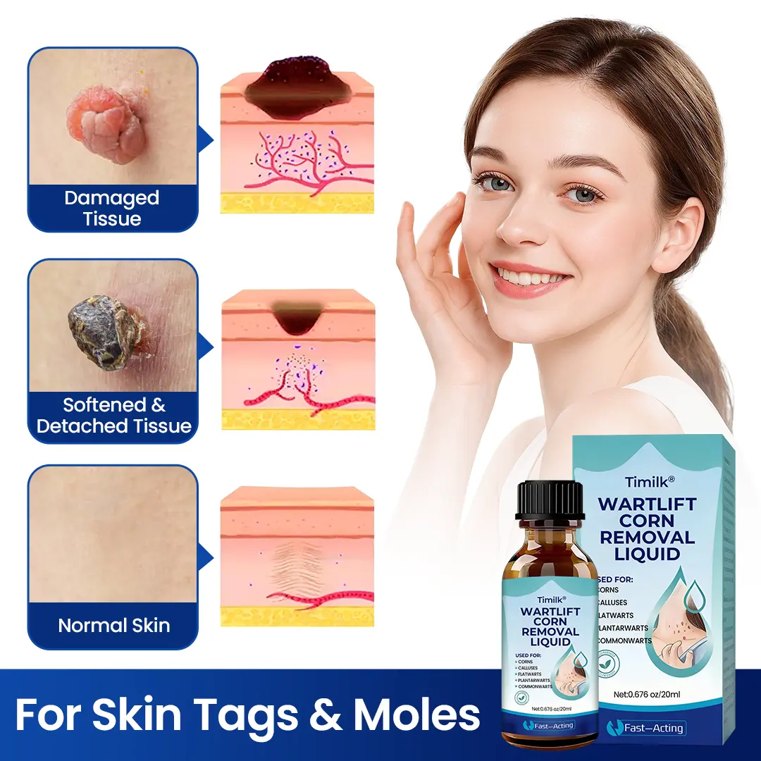 Timilk® WartLift Corn Removal Liquid (A)