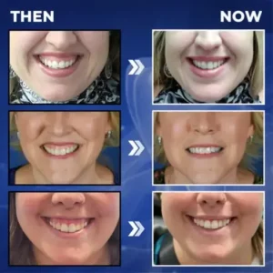 Croaie® ApiGuard BeeVenom Therapeutic Oral Drops & Rinse