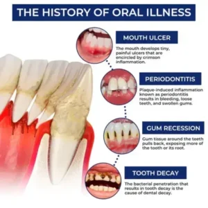 Croaie® ApiGuard BeeVenom Therapeutic Oral Drops & Rinse