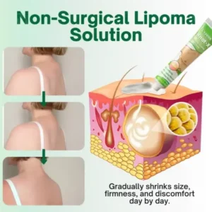 Cvreoz® Knot-X Lipoma Dissolve Cream