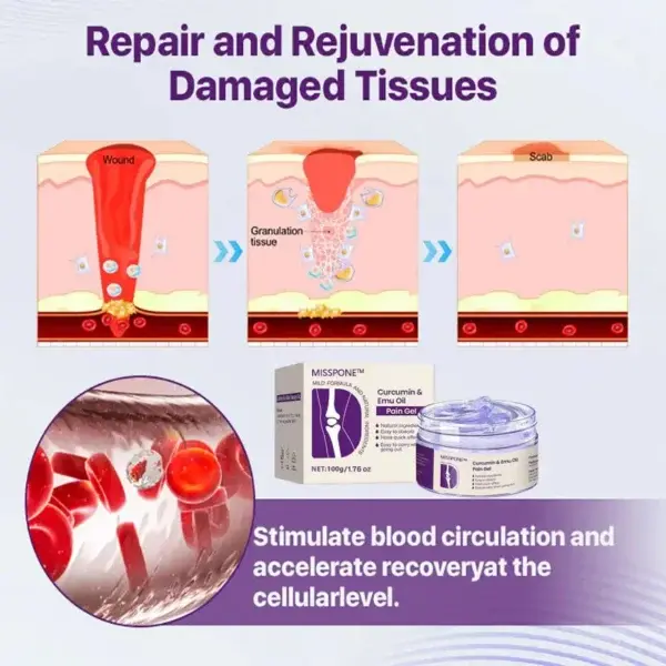 Misspone™ Curcumin & Emu Oil Pain Gel